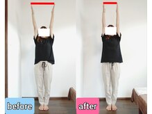 エンビジョン(ENVISION)/before→after