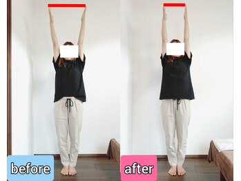 エンビジョン(ENVISION)/before→after