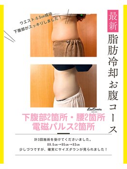 ヒーリングリゾート ナゴミ(Nagomi)/脂肪冷却◆お腹コース