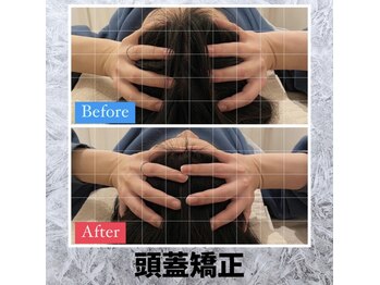 ルーツ 赤羽店(R∞ts)/小顔矯正/個貌術