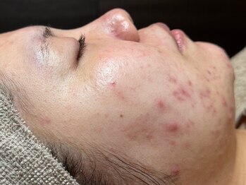 フィール(feel)/Before 1回目