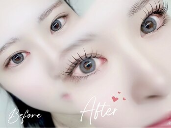 ユリシス(Ulysses)/上下まつげで中顔面短縮*