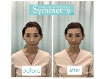 シンメトリー 池袋店