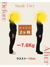 スマイル鍼灸整骨院 南熊本院/スマイルダイエット