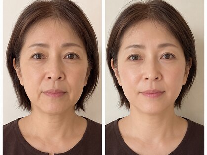 サロンアイ(salon i)の写真
