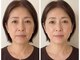 サロンアイ(salon i)の写真