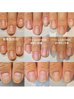 ニコプラス(NICO+)/自爪育成中