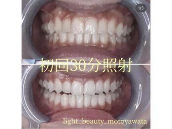 ライトビューティー 本八幡店(LIGHT BEAUTY)/初回30分体験でも効果を実感！