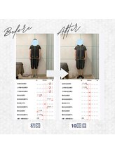 ラクリエ 東加古川院(La Creer)/お客様ビフォーアフター