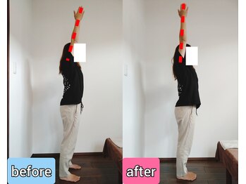 エンビジョン(ENVISION)/before→after