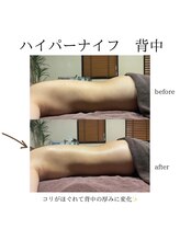 グランツ 小山店/ハイパーナイフビフォーアフター