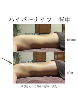 グランツ 小山店/ハイパーナイフビフォーアフター