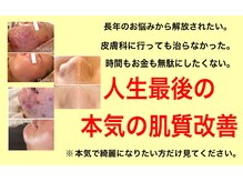 プランス 福岡(PLANCE)