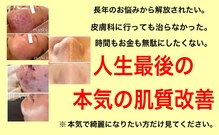 プランス 福岡(PLANCE)