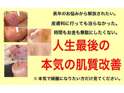 プランス 福岡(PLANCE)の写真