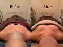 ジェイオー(J.O)/バストアップコルギ/小顔コルギ