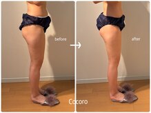 ココロ(Cocoro)/排出リンパマッサージ