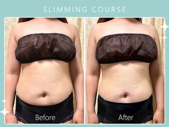 ハノハノ 八代店(HANO HANO)/選べる12種の痩身脂肪撃退☆