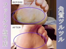 レーヌ青山(Reine Aoyama)の雰囲気（アロマリンパ/冷えむくみ/爪/魚の目/タコ/かかとケア/吸引後ケア）