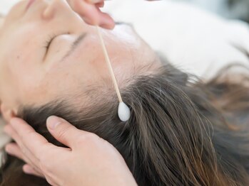 チップ(chip)の写真/気になる前から始めるのが大切☆頭皮のたるみはお顔のたるみへ直結!徹底ケアで◎