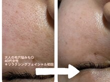 サロン ド ブラン(Salon de Blanc)/大人のゆるみ毛穴お任せください