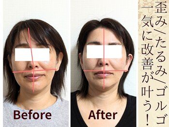 スウ(suu.)/Before-After【40代】8回
