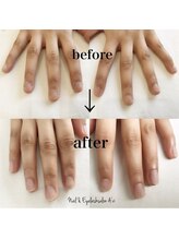 ネイルアンドアイラッシュ アヴィ(Nail and Eyelash A'vi)/自爪育成コース