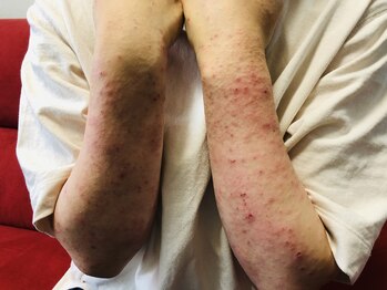 アンテリュール(Anterieur)/栄養学カウンセリング