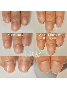 ニコプラス(NICO+)/自爪育成中