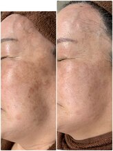 ジェルベーラ(GERBERA)/リバイブハーブトリートメント！