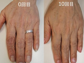 人前で恥ずかしくない【手に！】