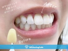 ホワイトニングカフェ アスピア明石店(WhiteningCafe)の雰囲気（1度で白く！ホワイトニング症例写真はフォトギャラリーをCheck★）