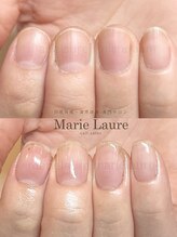 マリーロール 淀屋橋本店(Marie Laure)/自爪育成/深爪矯正/ネイルケア