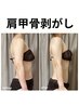 【背中美人】肩甲骨剥がし　50分
