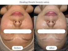 ヒーリングハーツ(Healing Hearts)/50代の肌管理もお任せください！