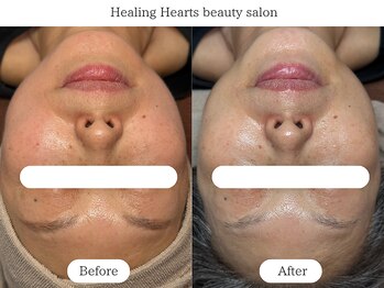 ヒーリングハーツ(Healing Hearts)/50代の肌管理もお任せください!