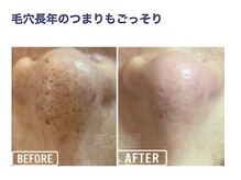 エミルカ 自由が丘店(EMILUCA)/長年の詰まりもごっそり