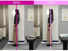 八女整体院/～姿勢改善～