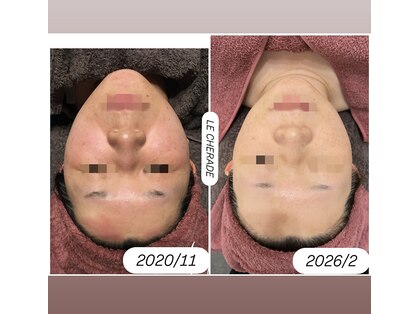 リシェラードの写真