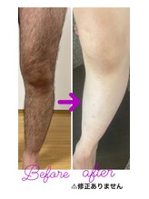 ツリービューティー(Tree Beauty)/★衝撃！before after★