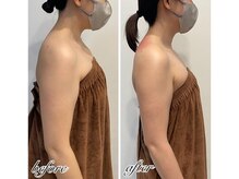 エンチャント(ENCHANT)/美ラインマッサージ