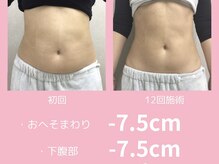 ラニ(LANI)/無理なくやせるなら腸活