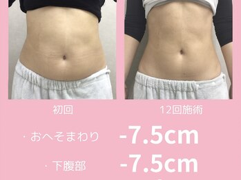 ラニ(LANI)/無理なくやせるなら腸活