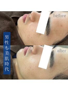 てづか整骨院 美咲が丘院/【サロンメンズ】フェイシャル