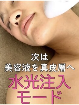 マヴィ くずは店(MavY.)/ノンニードル水光注入の秘密