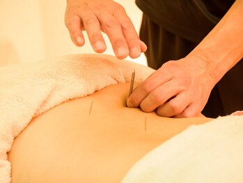 マハロ港南スポーツはりきゅう接骨院の写真/【長い施術歴/実績あり◎】慢性的な深いコリには鍼灸で直接アプローチ!健康的で疲れを溜めないお身体へ♪