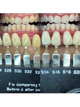 トウキョースワーズ 渋谷店(TOKYO SWRS)/#ホワイトニング #渋谷 #池袋