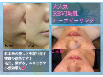ルアナ 柏本店(LUANA)の写真