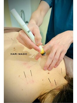 ハリマジック 代官山(HARI MAGIC)/【代官山/鍼灸/美容鍼】