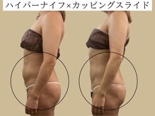 サロンハート(Salon Heart)/